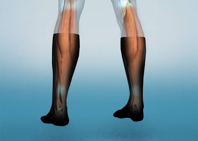 MEDICAL SOCKS 2A 658x470