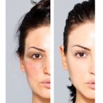 Krema za lice s puževom sluzi Celltone